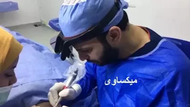 دكتور أحمد مكاوي استشاري جراحات التجميل خبرة اكتر من ١٥ سنة